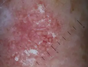 1 - Sapphire Clinic - Expert GP, Skin & Laser Care sapphire skin laser clinic