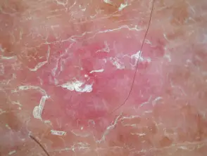 11 - Sapphire Clinic - Expert GP, Skin & Laser Care sapphire skin laser clinic