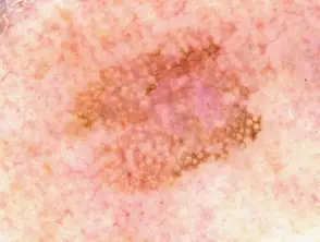 12 - Sapphire Clinic - Expert GP, Skin & Laser Care sapphire skin laser clinic