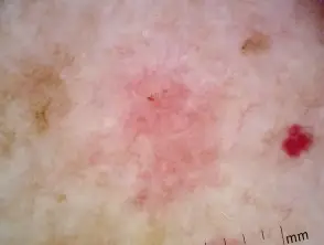 12 - Sapphire Clinic - Expert GP, Skin & Laser Care sapphire skin laser clinic