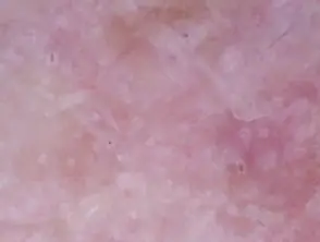 13 - Sapphire Clinic - Expert GP, Skin & Laser Care sapphire skin laser clinic