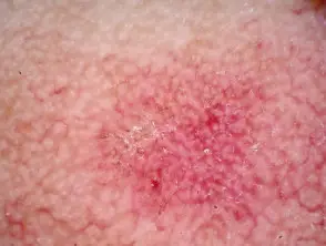 2 - Sapphire Clinic - Expert GP, Skin & Laser Care sapphire skin laser clinic