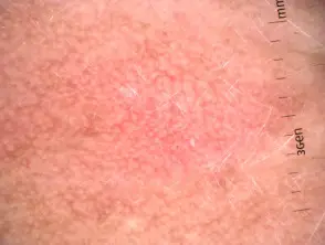 3 - Sapphire Clinic - Expert GP, Skin & Laser Care sapphire skin laser clinic