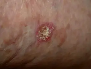 sapphire skin laser clinic