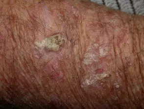 sapphire skin laser clinic